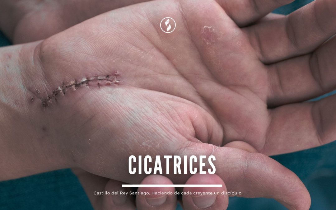 Cicatrices